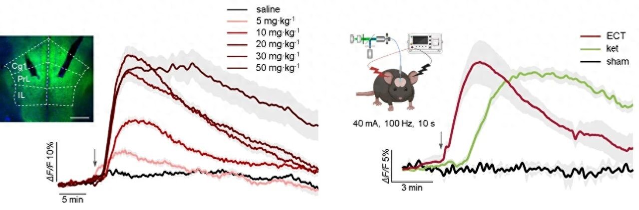 北京重度弱精症治疗经历_脑退化症怎么治疗_