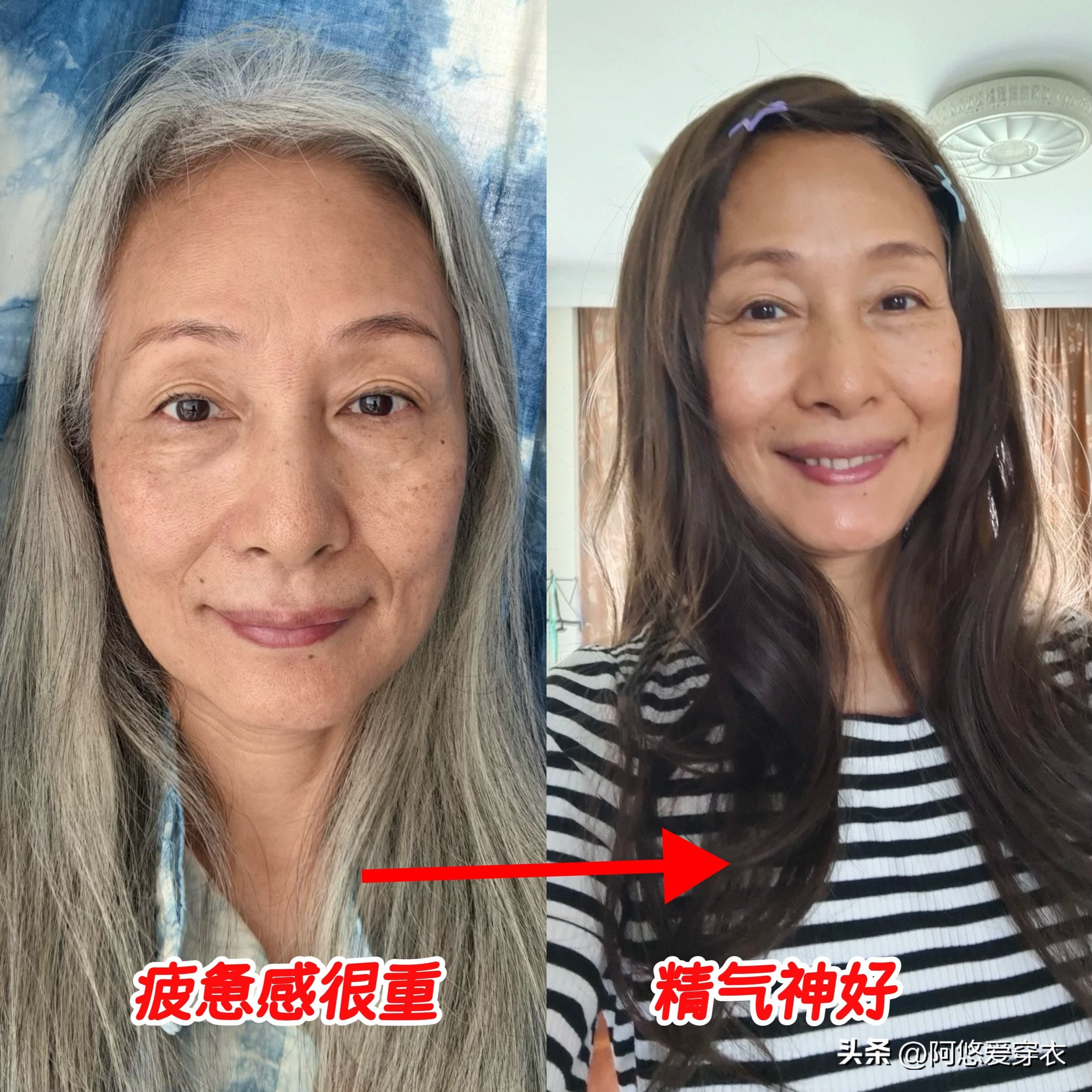 白发染霜是什么意思_白发暴露了年龄_