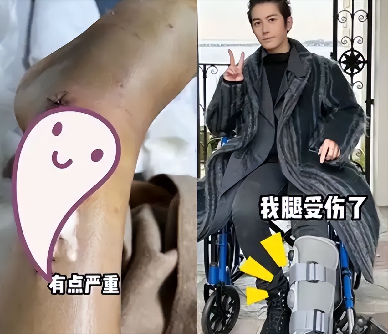 演员陈学冬:11部作品被下架,两年4次手术,今35岁生活无法自理_演员陈学冬:11部作品被下架,两年4次手术,今35岁生活无法自理_