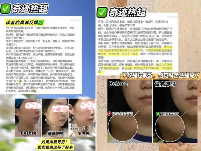 推广|| 她们新年状态大开挂？原来悄悄做了这笔“美丽投资”__推广|| 她们新年状态大开挂？原来悄悄做了这笔“美丽投资”