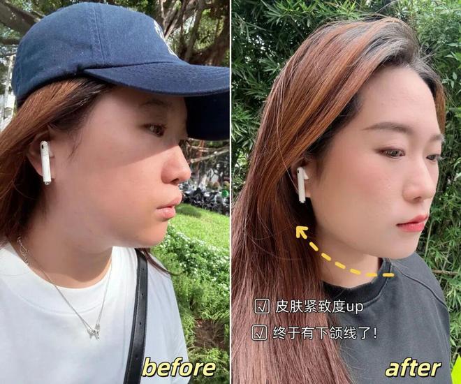 _推广|| 她们新年状态大开挂？原来悄悄做了这笔“美丽投资”_推广|| 她们新年状态大开挂？原来悄悄做了这笔“美丽投资”