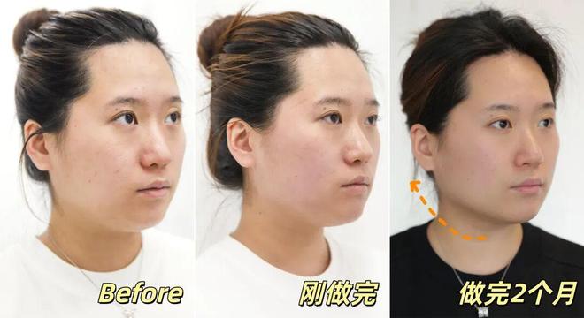 推广|| 她们新年状态大开挂？原来悄悄做了这笔“美丽投资”__推广|| 她们新年状态大开挂？原来悄悄做了这笔“美丽投资”