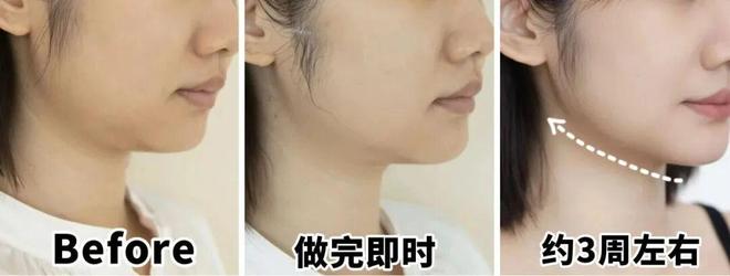 推广|| 她们新年状态大开挂？原来悄悄做了这笔“美丽投资”__推广|| 她们新年状态大开挂？原来悄悄做了这笔“美丽投资”