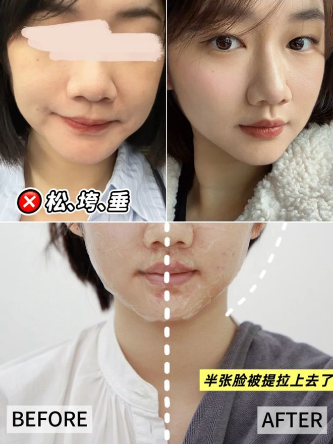 _推广|| 她们新年状态大开挂？原来悄悄做了这笔“美丽投资”_推广|| 她们新年状态大开挂？原来悄悄做了这笔“美丽投资”