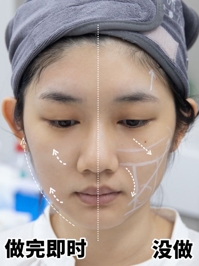 推广|| 她们新年状态大开挂？原来悄悄做了这笔“美丽投资”_推广|| 她们新年状态大开挂？原来悄悄做了这笔“美丽投资”_