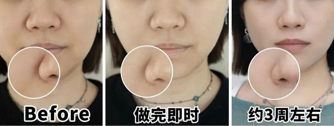 推广|| 她们新年状态大开挂？原来悄悄做了这笔“美丽投资”_推广|| 她们新年状态大开挂？原来悄悄做了这笔“美丽投资”_