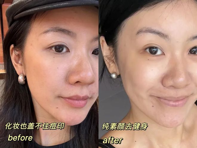 推广|| 她们新年状态大开挂？原来悄悄做了这笔“美丽投资”__推广|| 她们新年状态大开挂？原来悄悄做了这笔“美丽投资”