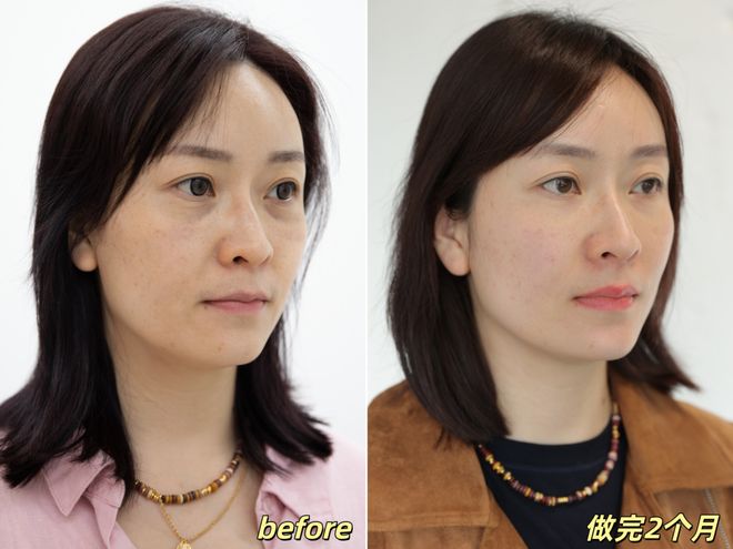 _推广|| 她们新年状态大开挂？原来悄悄做了这笔“美丽投资”_推广|| 她们新年状态大开挂？原来悄悄做了这笔“美丽投资”