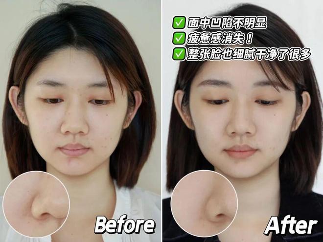 推广|| 她们新年状态大开挂？原来悄悄做了这笔“美丽投资”_推广|| 她们新年状态大开挂？原来悄悄做了这笔“美丽投资”_