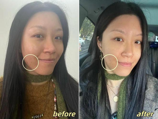 _推广|| 她们新年状态大开挂？原来悄悄做了这笔“美丽投资”_推广|| 她们新年状态大开挂？原来悄悄做了这笔“美丽投资”