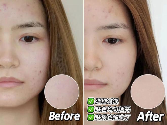 推广|| 她们新年状态大开挂？原来悄悄做了这笔“美丽投资”_推广|| 她们新年状态大开挂？原来悄悄做了这笔“美丽投资”_