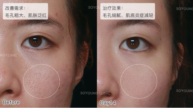 推广|| 她们新年状态大开挂？原来悄悄做了这笔“美丽投资”_推广|| 她们新年状态大开挂？原来悄悄做了这笔“美丽投资”_