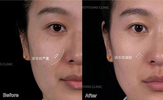 推广|| 她们新年状态大开挂？原来悄悄做了这笔“美丽投资”_推广|| 她们新年状态大开挂？原来悄悄做了这笔“美丽投资”_