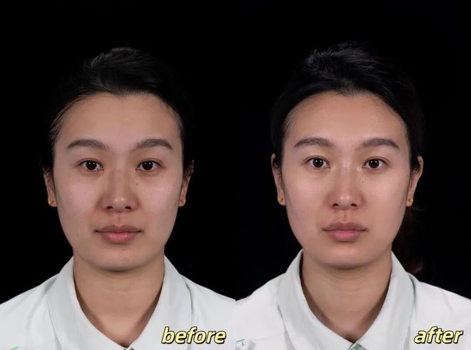 _推广|| 她们新年状态大开挂？原来悄悄做了这笔“美丽投资”_推广|| 她们新年状态大开挂？原来悄悄做了这笔“美丽投资”