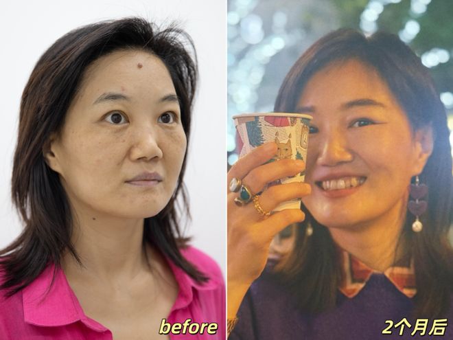 _推广|| 她们新年状态大开挂？原来悄悄做了这笔“美丽投资”_推广|| 她们新年状态大开挂？原来悄悄做了这笔“美丽投资”