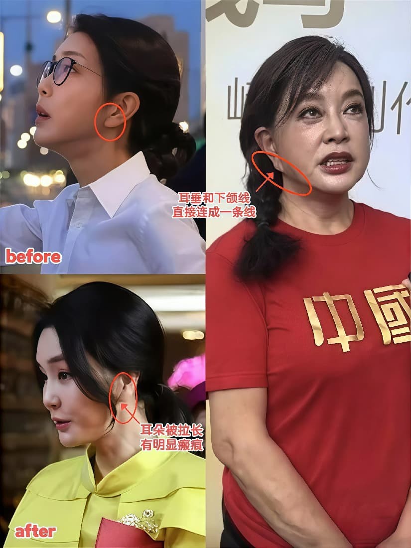 富贵脸相__面部富贵相有哪些