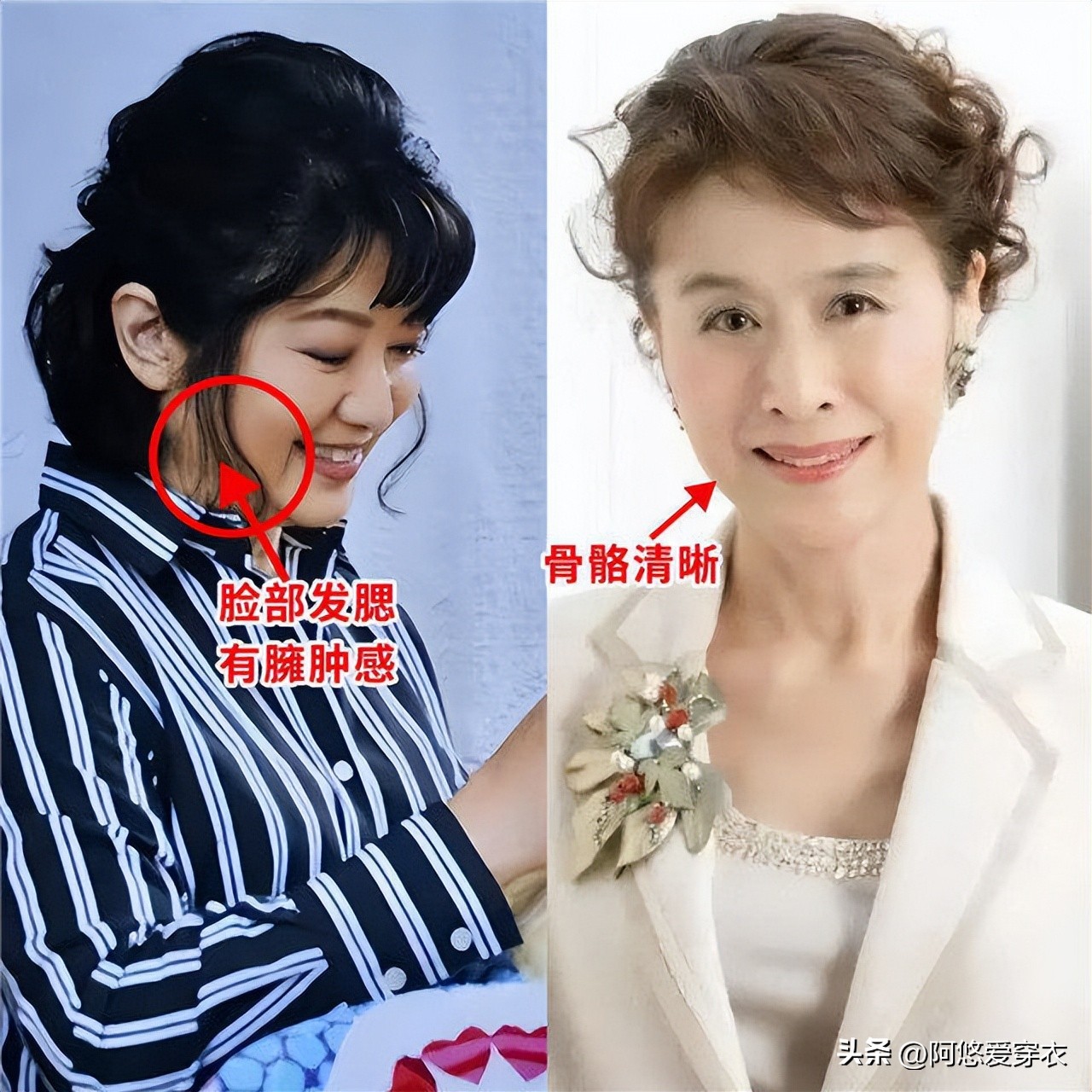 摩根烫是烫全头吗_全头烫可以丸子头_