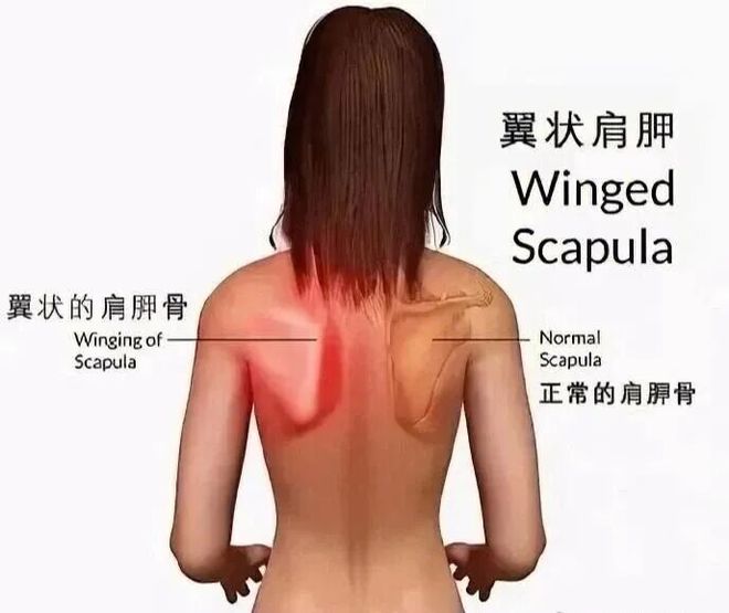 练背避免大圆肌发力_胸和背是对抗肌没人_