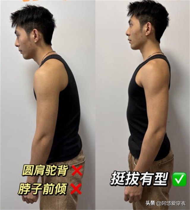 _整容的对比_整容成功前后对比