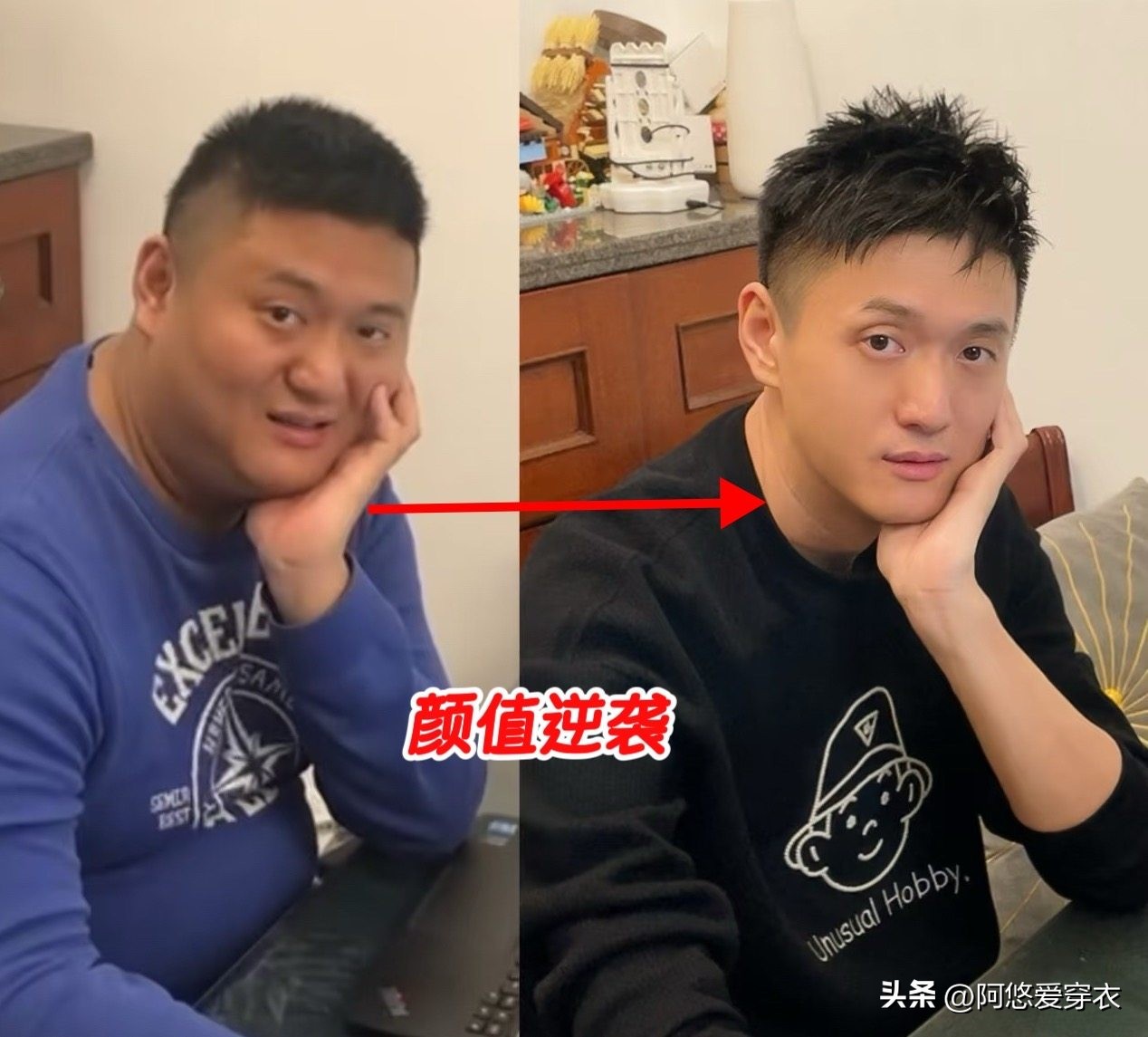 整容成功前后对比__整容的对比