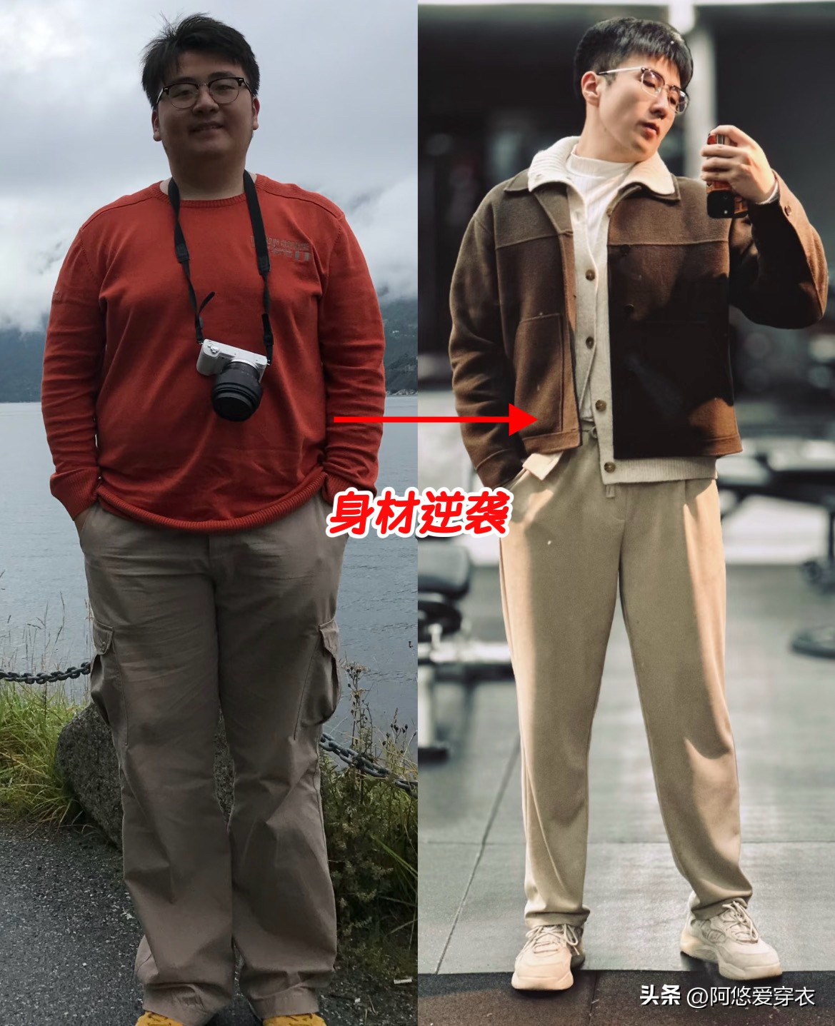 _整容的对比_整容成功前后对比