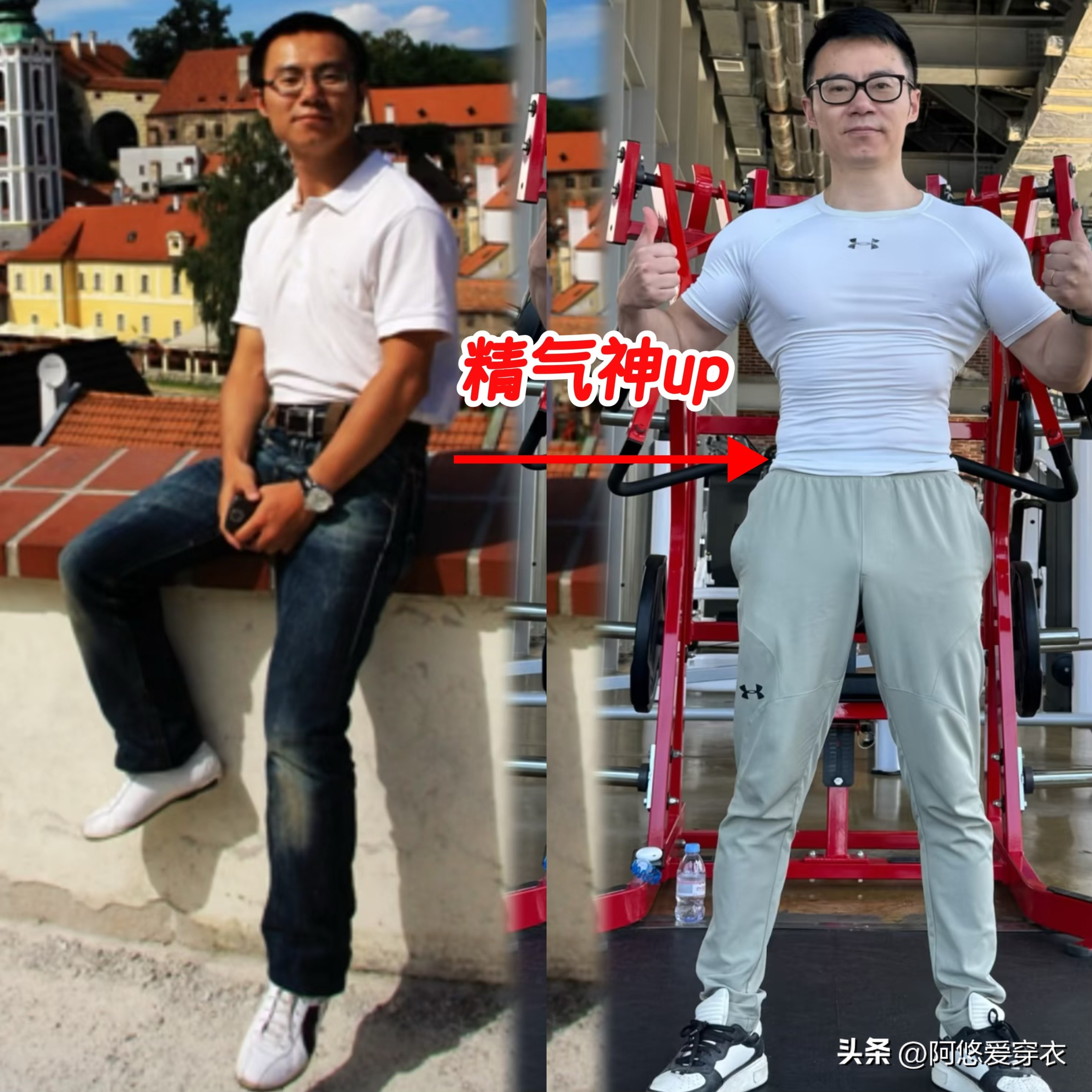 _整容的对比_整容成功前后对比