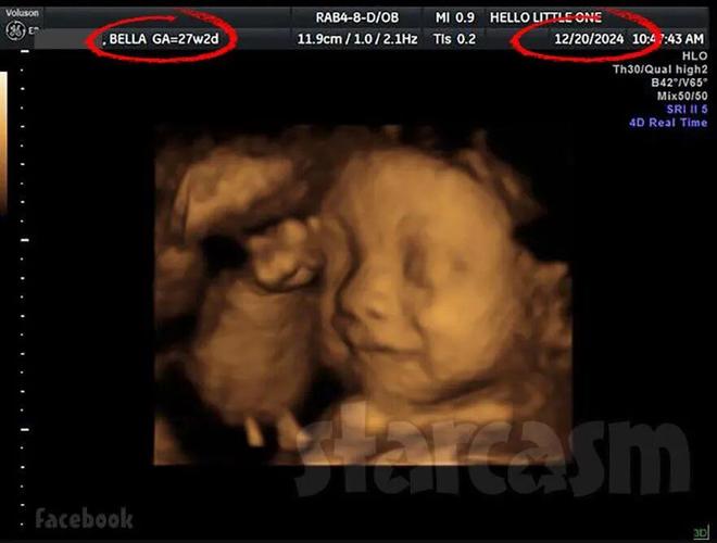 傻爹傻妈__傻爸傻妈破落家