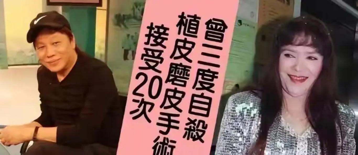_梁小龙之后再无陈真！因爱国被封杀20年，发妻被泼硫酸毁容_梁小龙之后再无陈真！因爱国被封杀20年，发妻被泼硫酸毁容