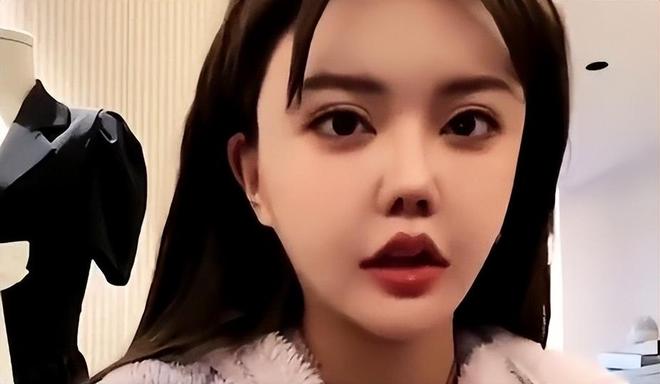 _整容整惨的明星_整容悲剧