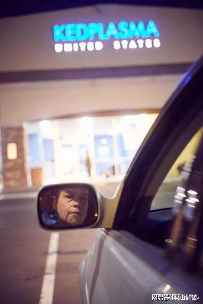 每天都在逃命_激光脱发际线脱高了_