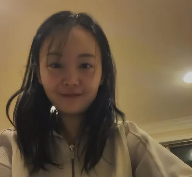 郑爽分享美国近况，穿搭不输当红明星，自曝做医美网友直呼认不出